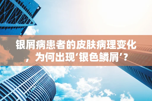 银屑病患者的皮肤病理变化，为何出现‘银色鳞屑’？