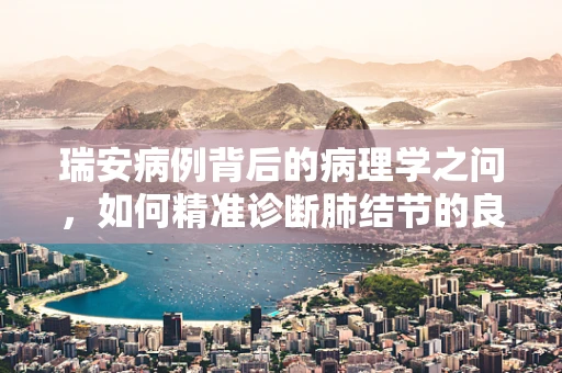 瑞安病例背后的病理学之问，如何精准诊断肺结节的良恶性？