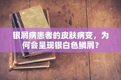 银屑病患者的皮肤病变，为何会呈现银白色鳞屑？