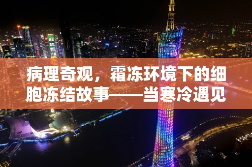 病理奇观，霜冻环境下的细胞冻结故事——当寒冷遇见生命科学