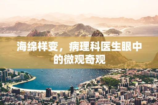 海绵样变，病理科医生眼中的微观奇观
