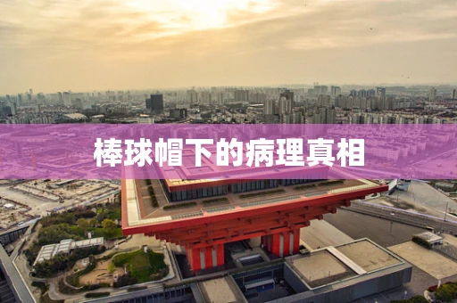 棒球帽下的病理真相