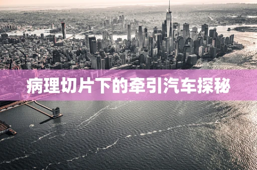 病理切片下的牵引汽车探秘