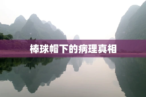 棒球帽下的病理真相