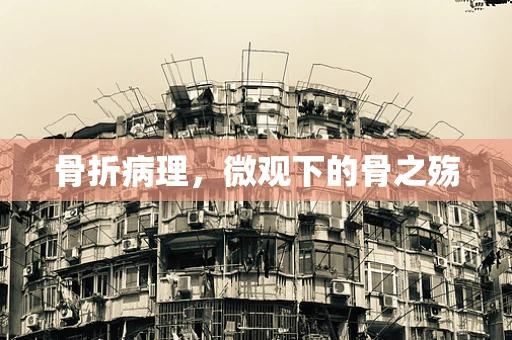 骨折病理，微观下的骨之殇