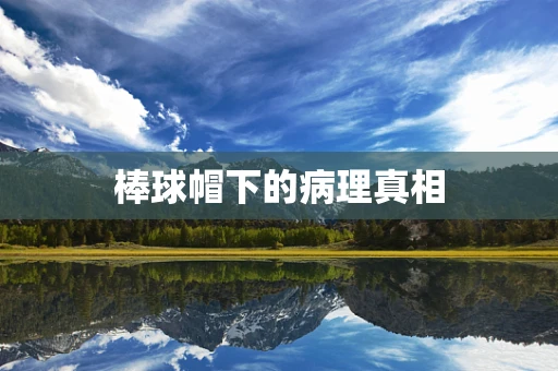 棒球帽下的病理真相