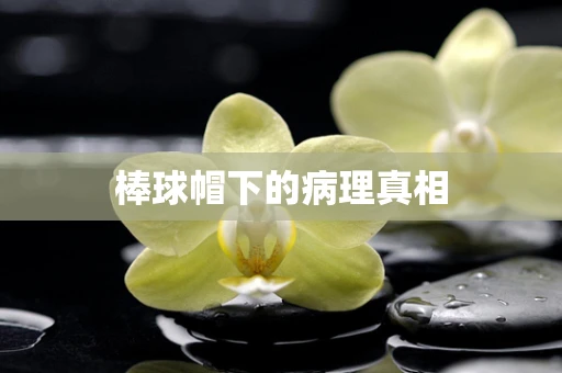 棒球帽下的病理真相