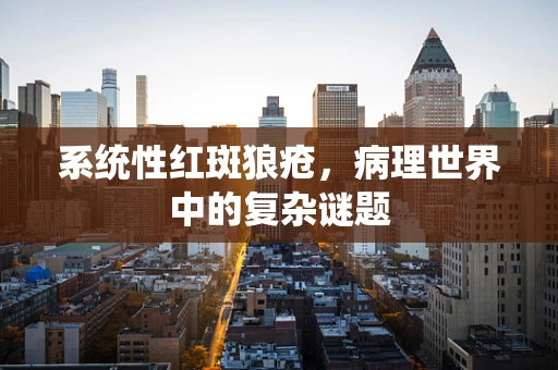 系统性红斑狼疮，病理世界中的复杂谜题