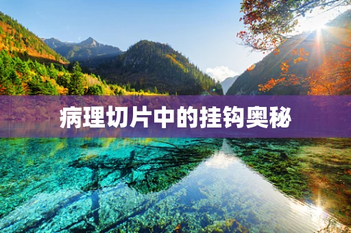 病理切片中的挂钩奥秘