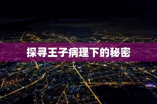 探寻王子病理下的秘密