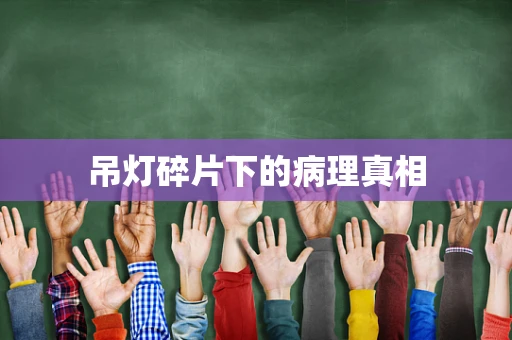 吊灯碎片下的病理真相